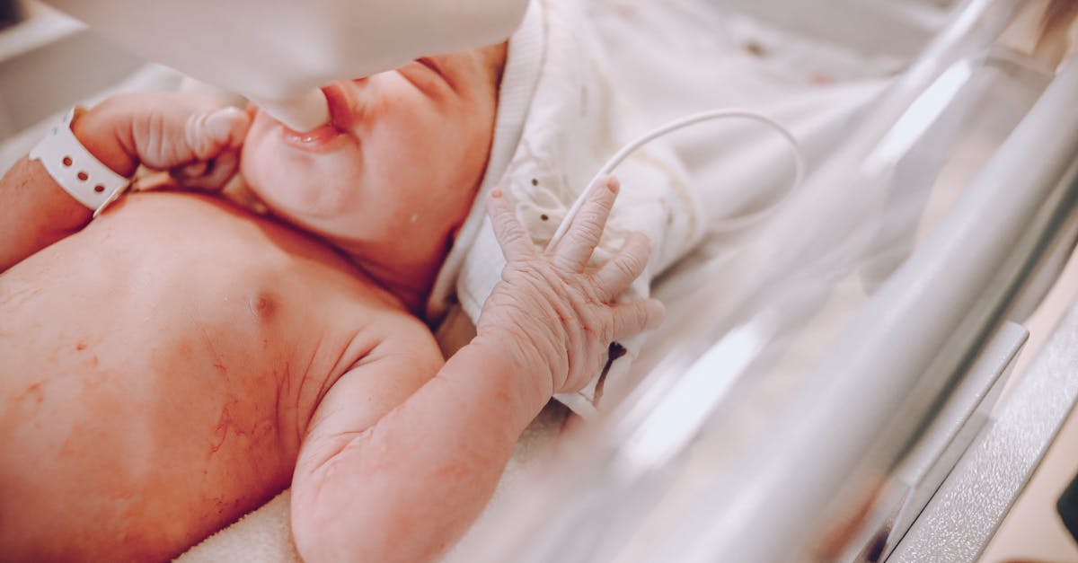 découvrez tout ce qu'il faut savoir sur l'hernie ombilicale : causes, symptômes, diagnostic et options de traitement. informez-vous sur cette condition fréquente et apprenez comment la gérer efficacement.