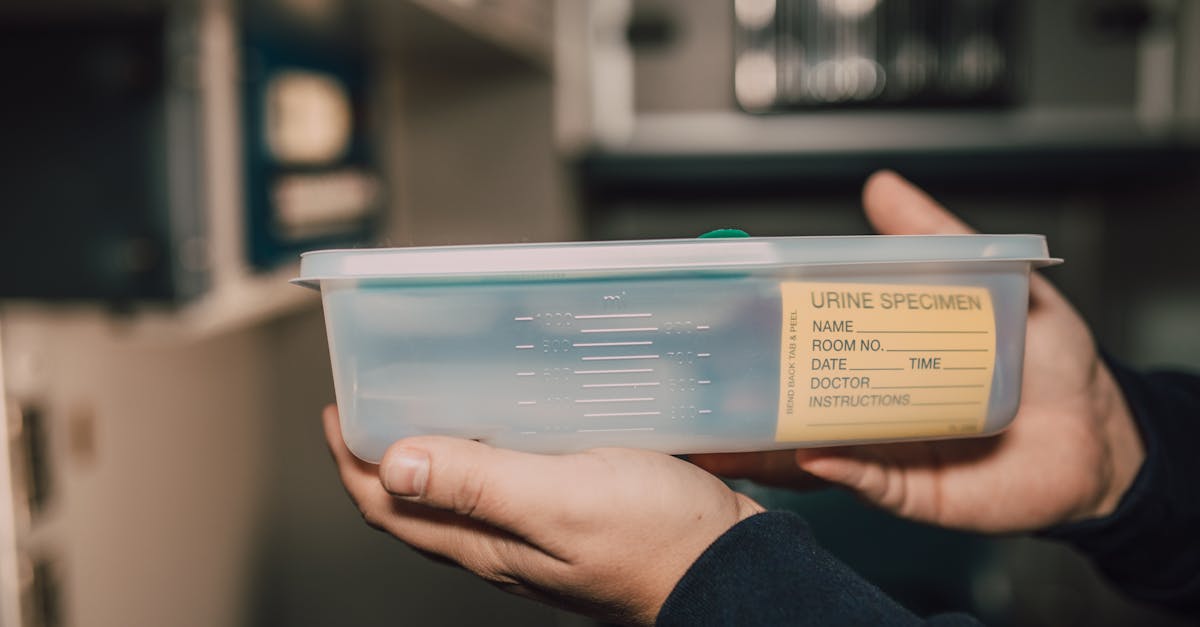 découvrez les causes et les solutions possibles pour une urine malodorante. apprenez à identifier les signes d'alerte et quand consulter un professionnel de santé.