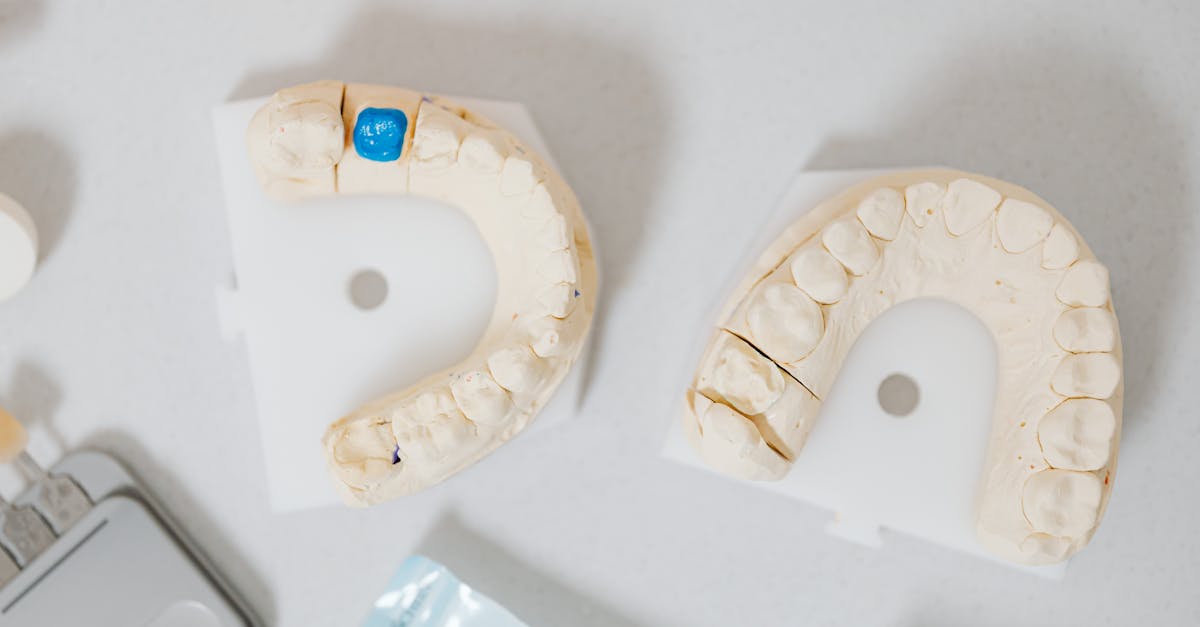 découvrez tout ce qu'il faut savoir sur les implants dentaires : avantages, processus d'implantation et résultats esthétiques. améliorez votre sourire avec des solutions durables et efficaces pour retrouver une dentition saine et fonctionnelle.