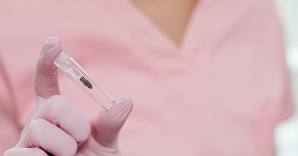 découvrez les implants dentaires, une solution durable pour remplacer vos dents manquantes. améliorez votre sourire et votre qualité de vie grâce à des implants de haute qualité, adaptés à vos besoins. informez-vous sur le processus, les avantages et les soins nécessaires pour un résultat optimal.