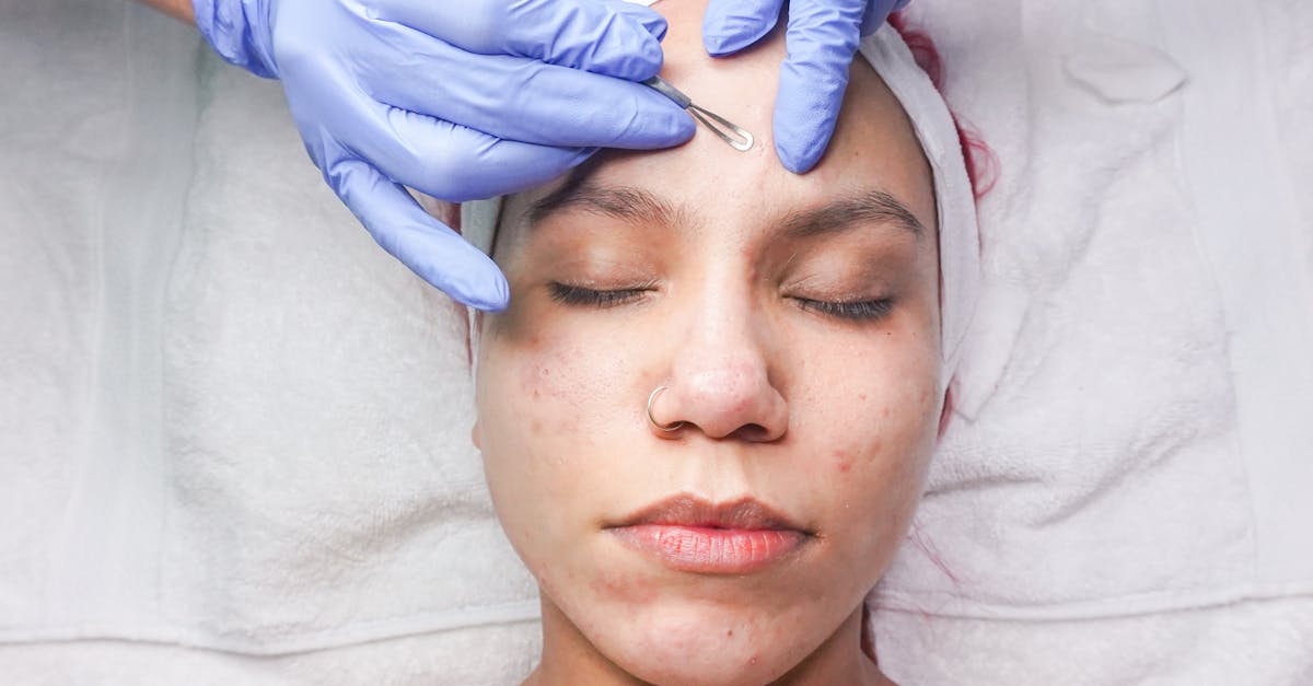 découvrez les meilleurs aliments pour lutter contre l'acné et améliorer la santé de votre peau grâce à une alimentation adaptée.