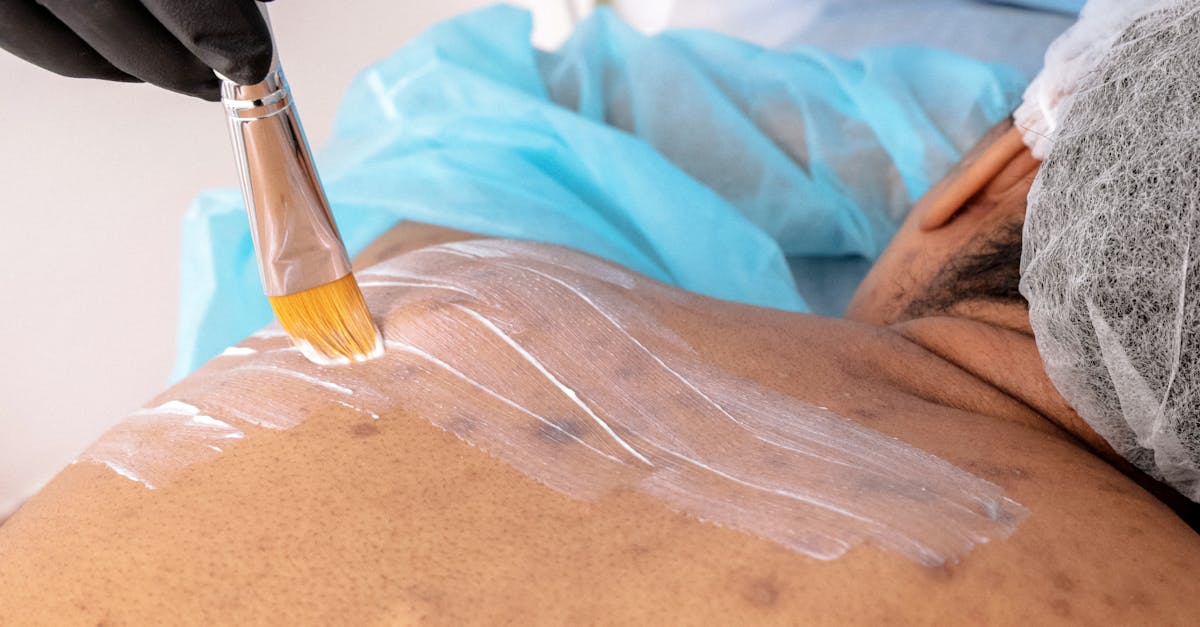 découvrez les aliments recommandés pour lutter contre l'acné et améliorer la santé de votre peau grâce à une alimentation équilibrée.