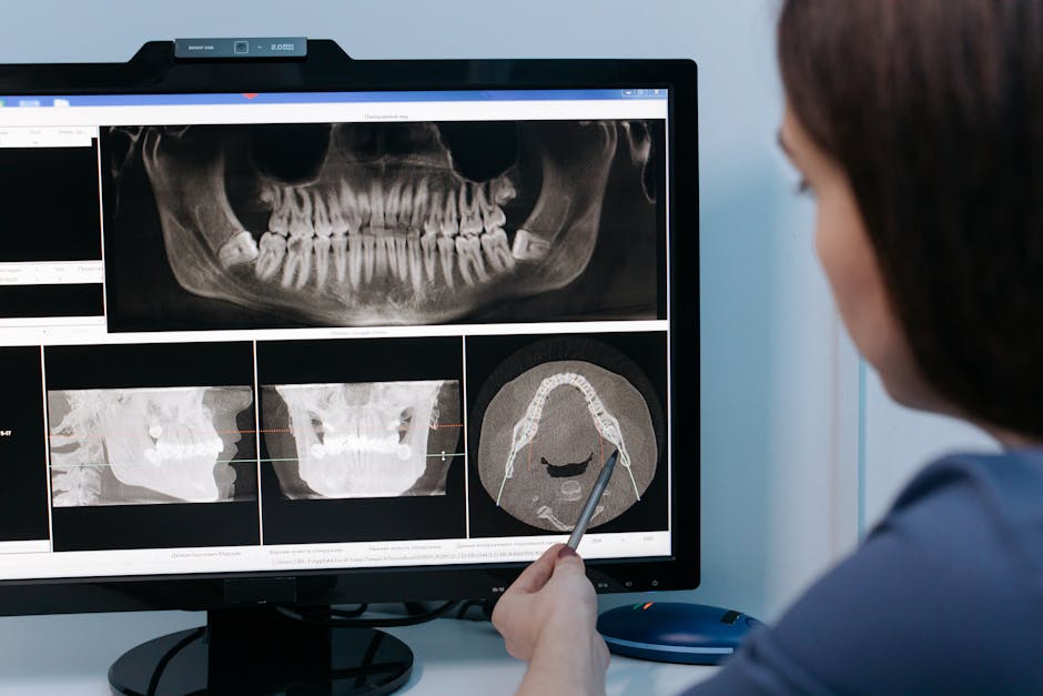 Close-up of dental x-ray showing impacted wisdom tooth