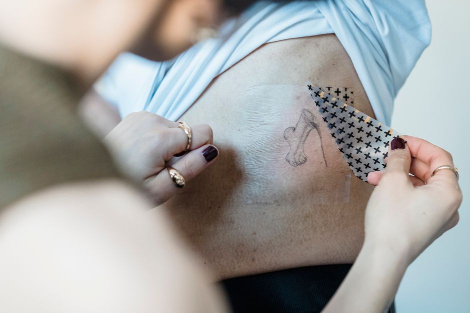 Black temporary tattoo on skin illustrating allergic reaction and irritation