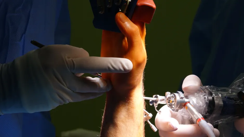 Detailed view of wrist surgery procedure with medical instruments and gloved hands.