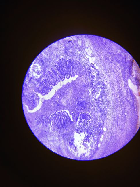 Microscopic view of a blue-stained tissue sample showing detailed histology.