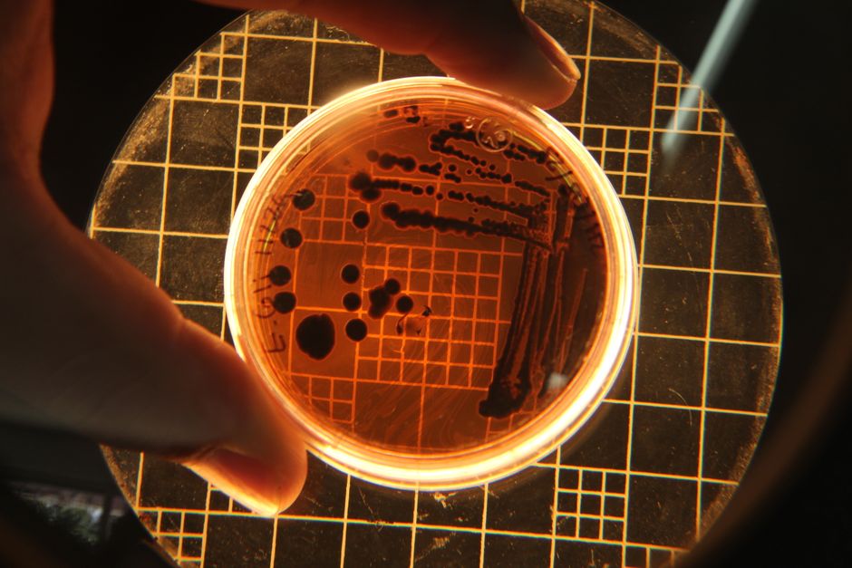 Les bactéries sont-elles vraiment toutes dangereuses? Close-up of bacterial colonies in a Petri dish under a microscope in a lab setting.