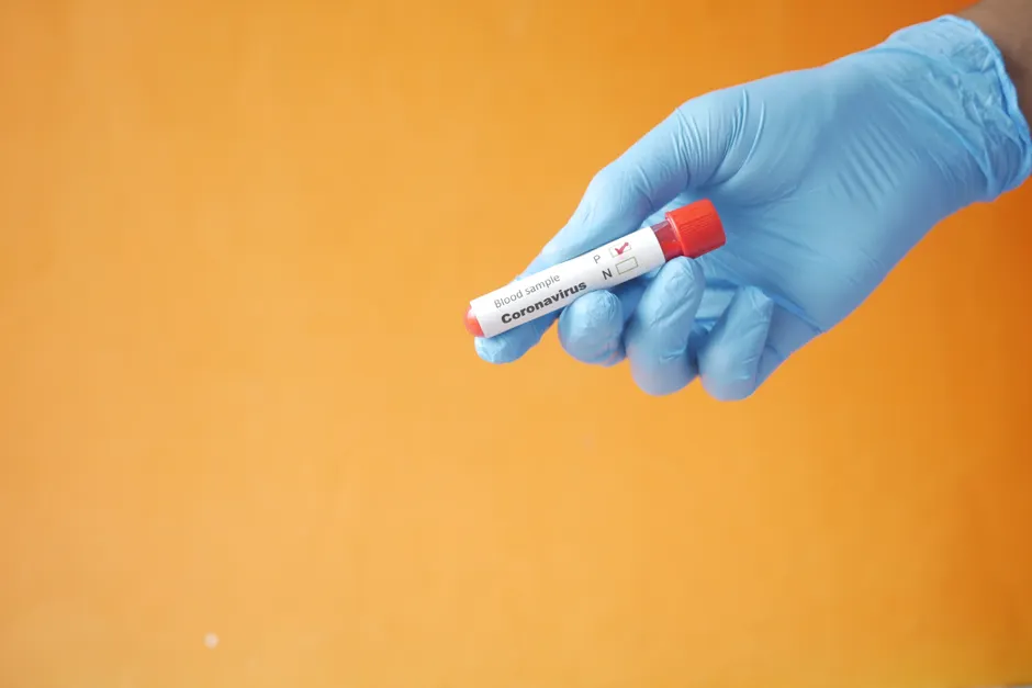 Close-up of a gloved hand holding a coronavirus blood sample tube against an orange background.
