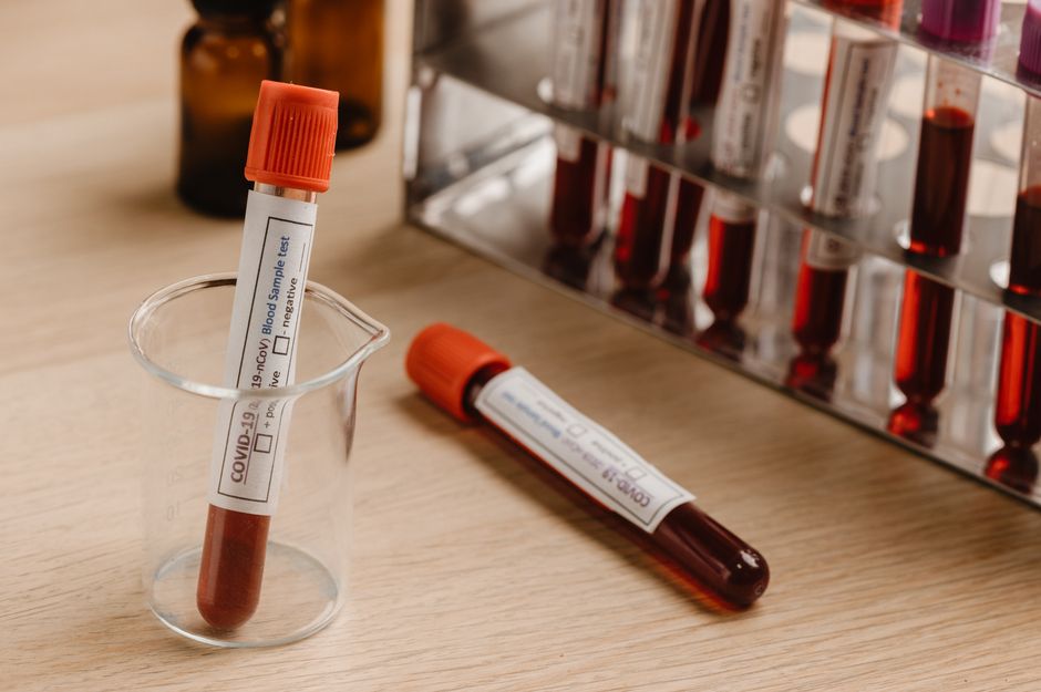 Close-up of blood sample tubes for Covid-19 testing in a laboratory setting.