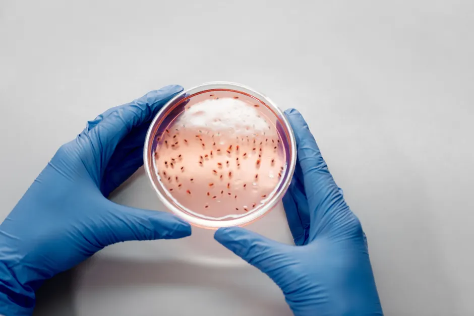 Les antibiotiques rendent-ils vraiment les bactéries résistantes? Close-up of gloved hands holding a petri dish with bacterial cultures for scientific analysis.