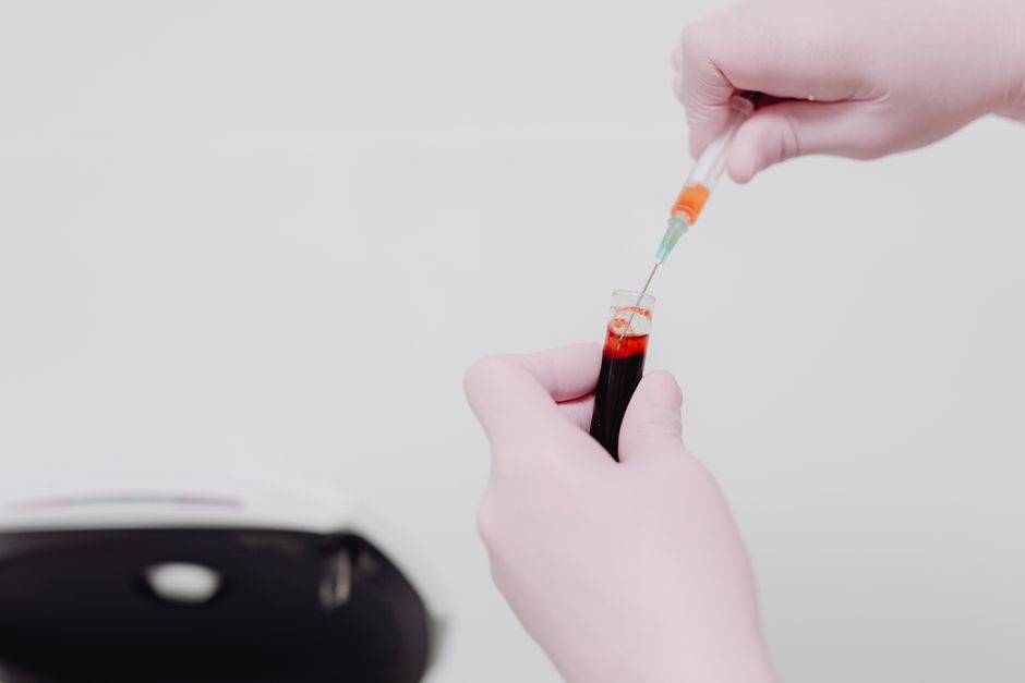 Des nanoplastiques ont-ils déjà été retrouvés dans le sang humain? Lab technician using a syringe to handle a blood sample. Medical analysis concept.