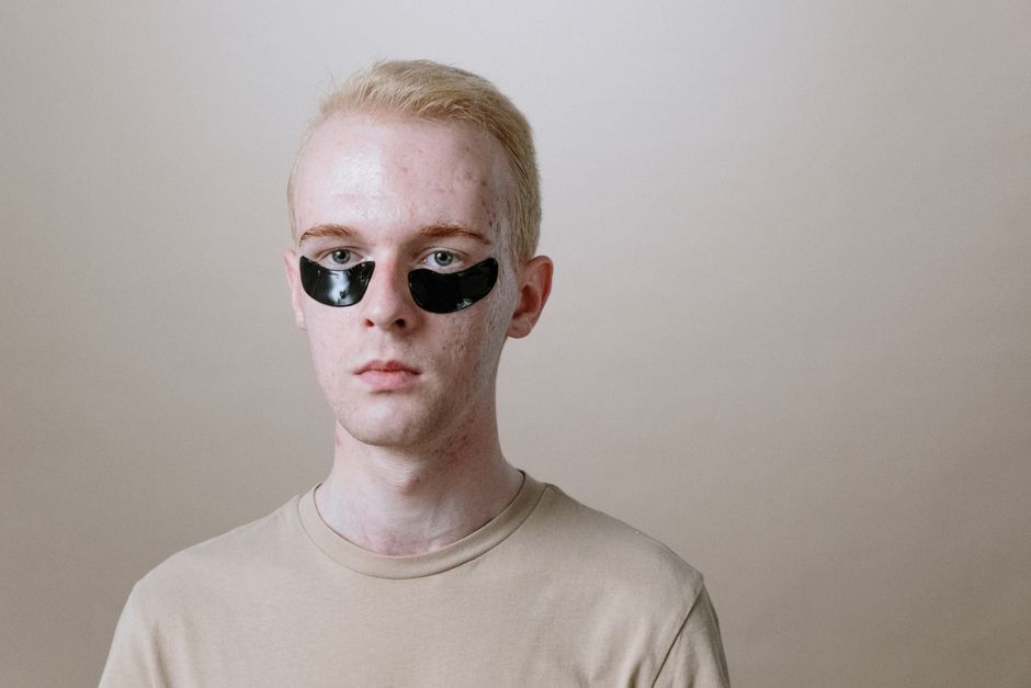 Les pirates portaient-ils vraiment des cache-œils? Portrait of a young man wearing under-eye patches, focusing on skincare and self-care routine.