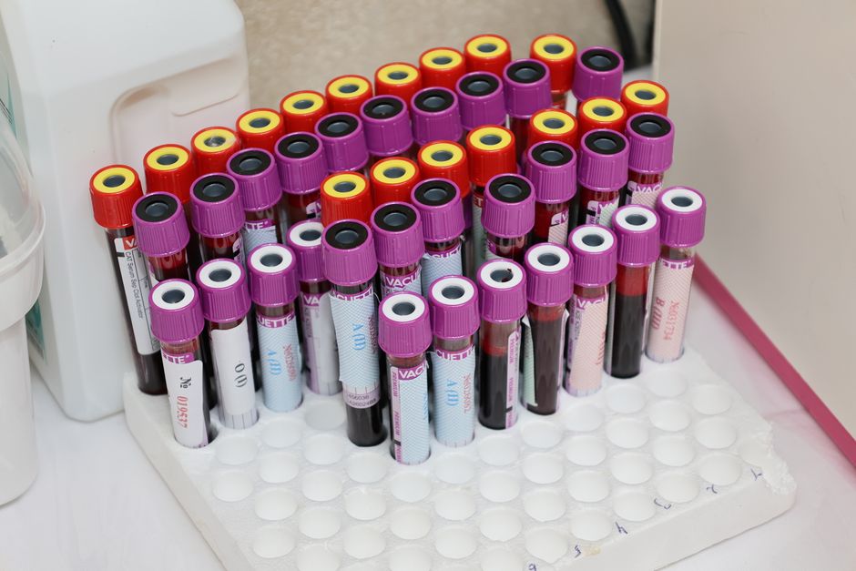 L’immunité naturelle est-elle vraiment supérieure à la vaccination? Rows of blood vials in a laboratory setting, ready for analysis.